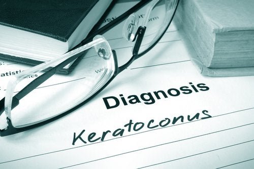 Ceratocone: que doença é essa?