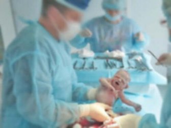 Doenças do recém-nascido tratadas com cirurgia