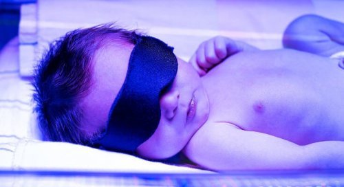 Fototerapia em recém nascido