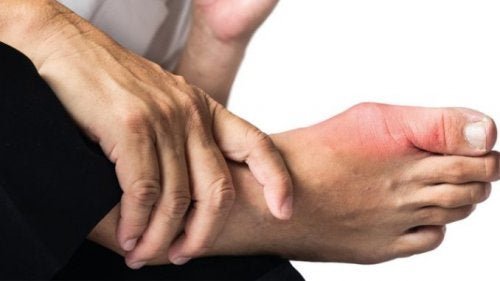 Sinal de gota no pé