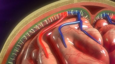 Bomba de infusão: para que serve e quais cuidados o paciente deve ter?