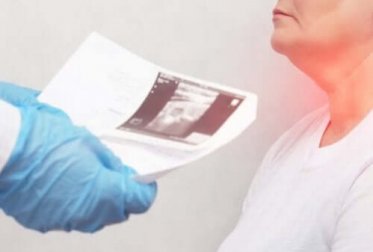 Nódulos da tireoide: sintomas e causas