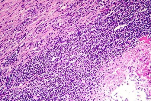 Tecido do pericárdio