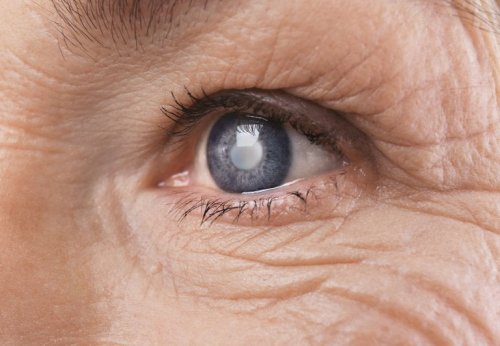 Retinopatia diabética