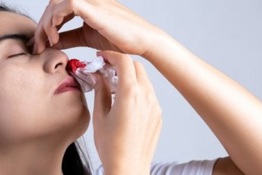 Por que o nariz sangra? 10 causas principais