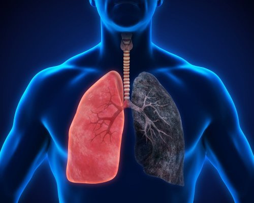 Comparação entre pulmão saudãvel e pulmão doente