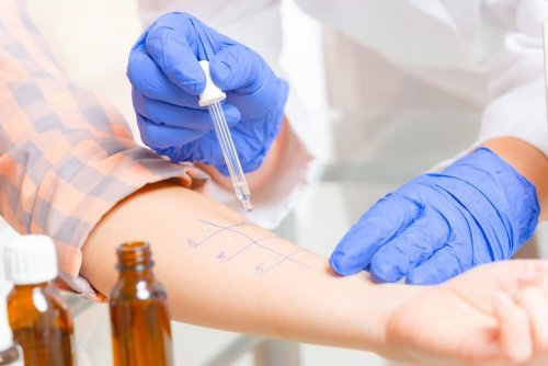 Teste de alergia