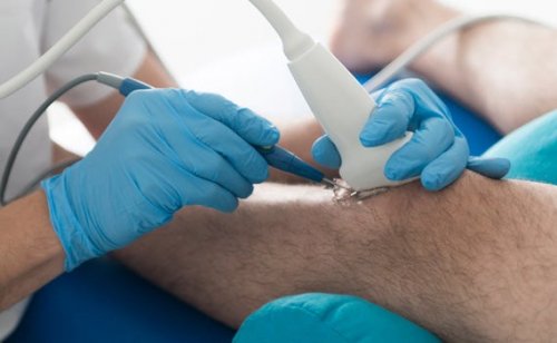 Tratamento da osteoartrite