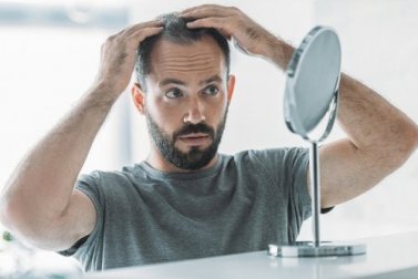 Alopecia androgenética: sintomas, causas e tratamento