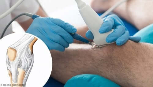 Operação minimamente invasiva do joelho