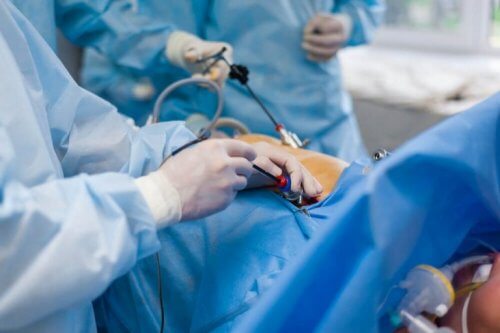 Cirurgia de intestino