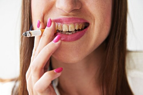 Dentes de fumador
