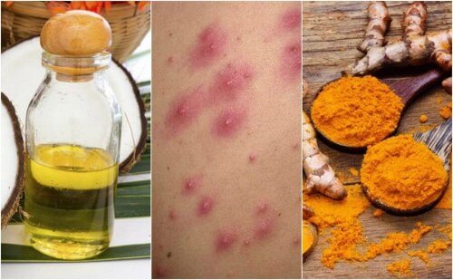 Tratamentos para espinhas na cabeça