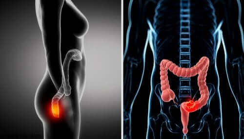Fisiologia do anus e do reto