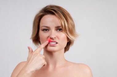 O que é herpes labial?