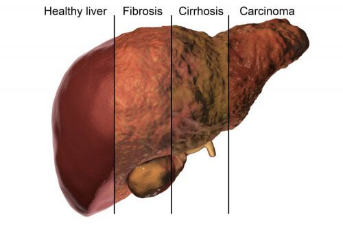 Partes do fígado