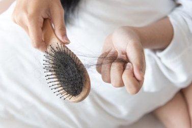 Por que o cabelo cai?