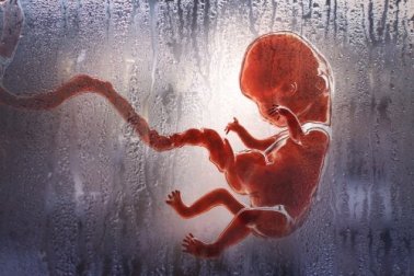 Tipos de abortos que você deve conhecer