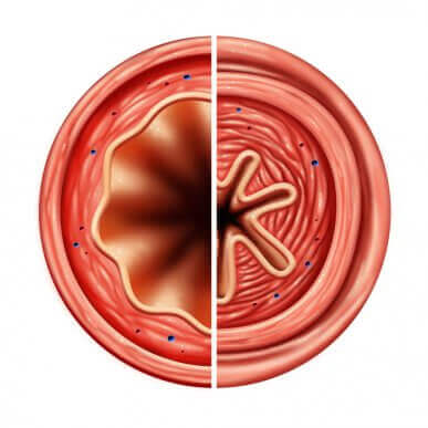 Antiasmáticos abrem a traqueia