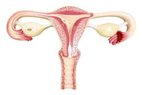 Ligadura de trompas de Falópio como contracepção
