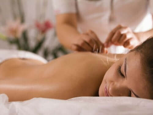 acupuntura pode aliviar os sintomas da fibromialgia.