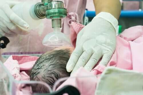 Bebê com respiração artificial