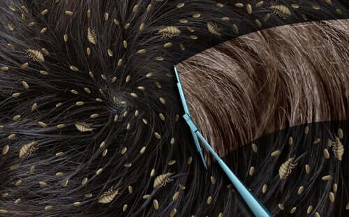 Cabelo com lêndeas