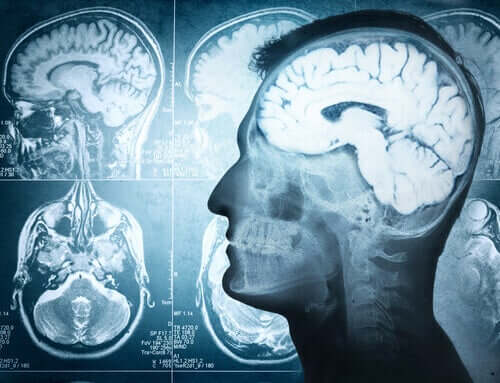 Edema cerebral
