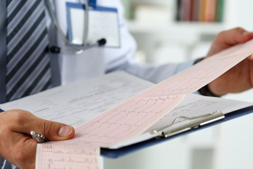 Eletrocardiograma