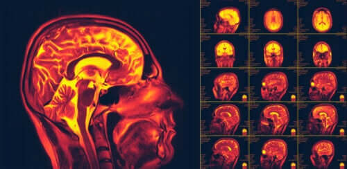 O que é neuroplasticidade?