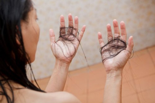 Mulher sofrendo com queda de cabelo