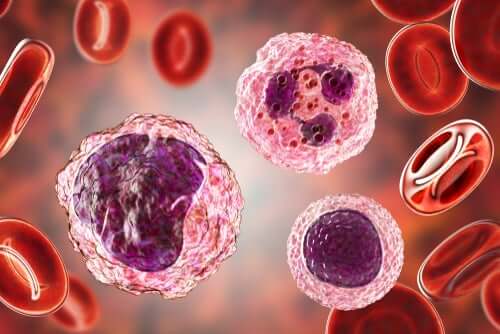 Nível alto de monócitos no sangue: sintomas e tratamento