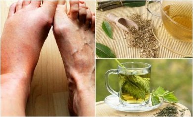 6 chás de ervas para diminuir o nível de ácido úrico no organismo