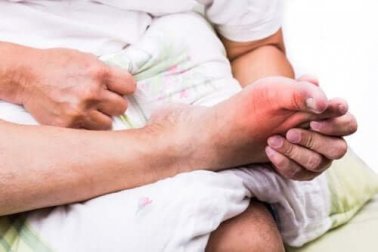 Dieta para a gota: recomendações e proibições