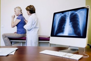 Asbestose: sinais e principais sintomas