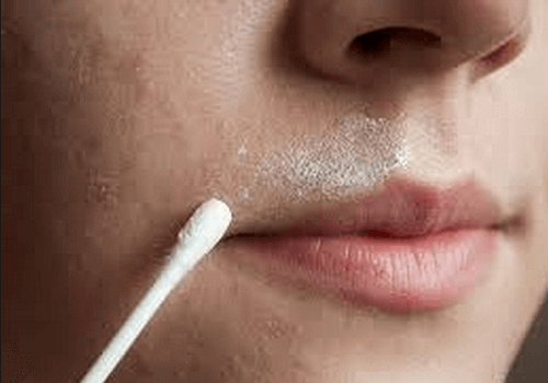 Excesso de pelos no corpo