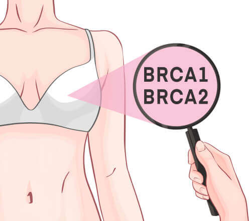 O papel dos genes BRCA-1 e 2 no câncer de mama