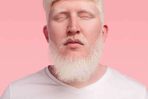 Homem albino de olhos fechados
