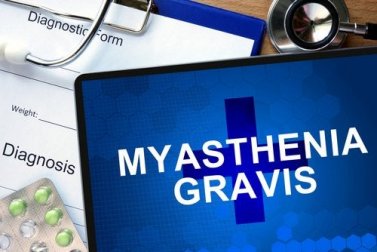 Miastenia gravis: tudo que você precisa saber sobre esta doença