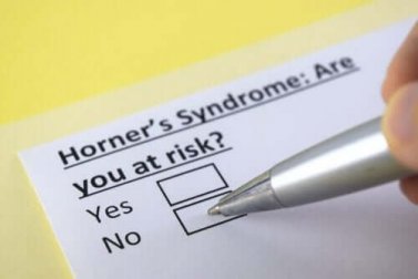O que é a síndrome de Horner?