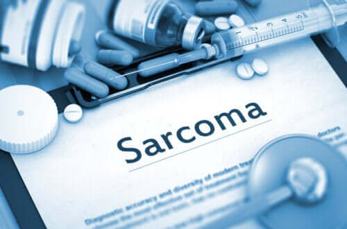 O que é um sarcoma?