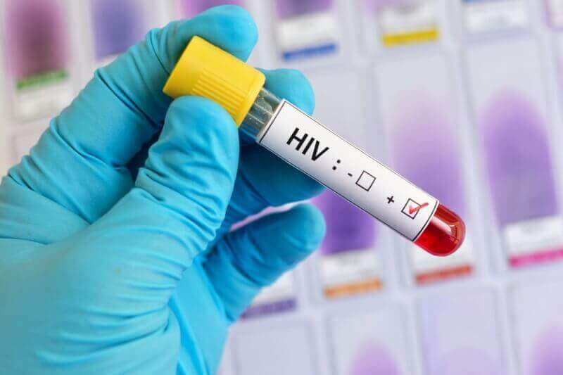 Teste de HIV positivo