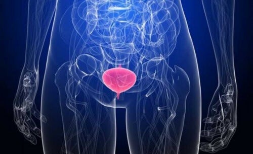 Infecção urinária em mulheres