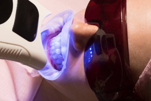 Tipos de clareamento dental