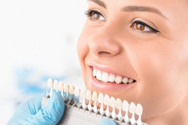 Clareamento dental: o que é e quais tipos existem?
