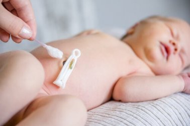 Cuidados com o umbigo do recém-nascido