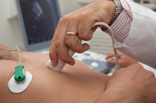 Ecocardiograma