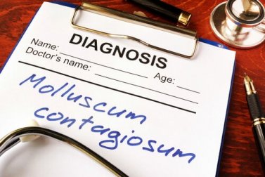 O que é o molusco contagioso?