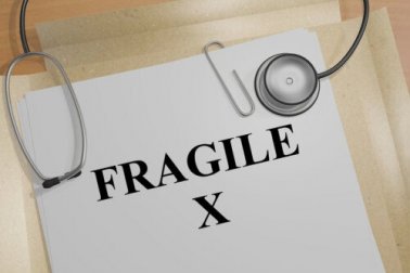Síndrome do X frágil: sintomas e tratamentos
