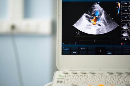 Válvula aórtica bicúspide: diagnóstico e tratamento